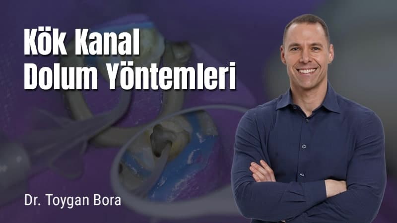 Kök Kanal Dolum Yöntemleri