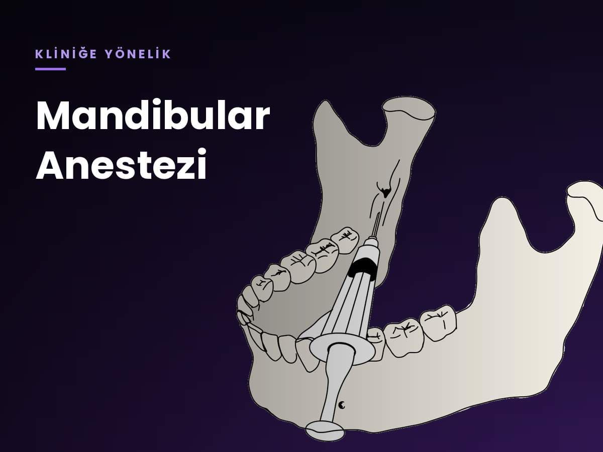 Mandibular Anestezi