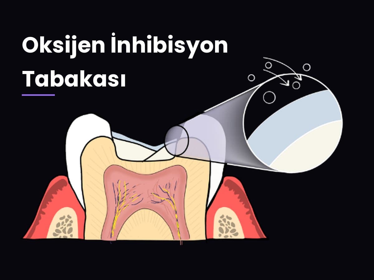 Oksijen İnhibisyon Tabakası