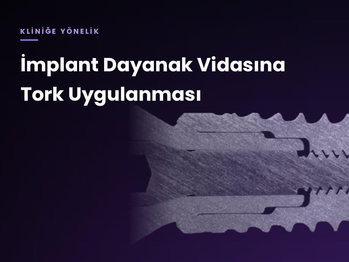 İmplant Dayanak Vidasına Tork Uygulanması