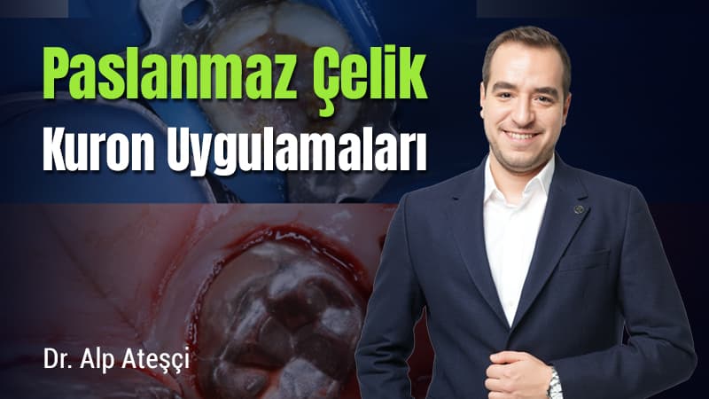 Paslanmaz Çelik Kuron Uygulamaları
