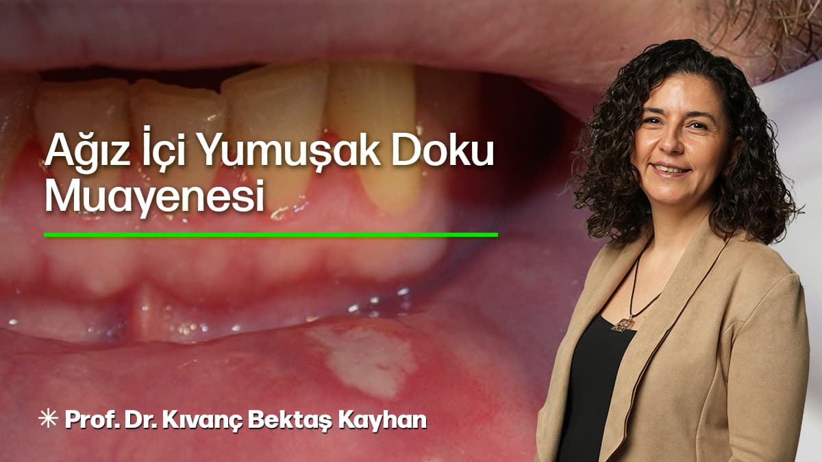 Ağız İçi Yumuşak Doku Muayenesi