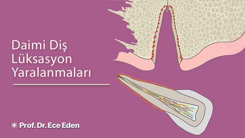 Daimi Diş Lüksasyon Yaralanmaları