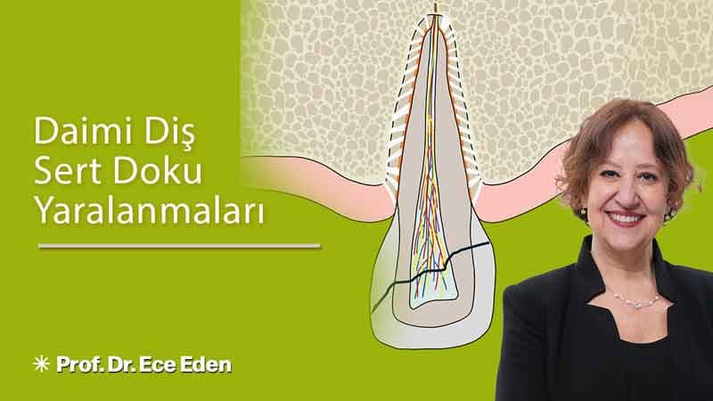 Daimi Diş Sert Doku Yaralanmaları