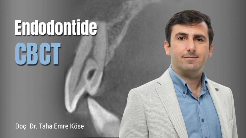 Endodontide CBCT