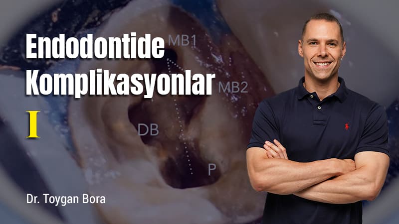Endodontide Komplikasyonlar - I