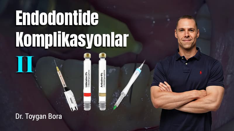 Endodontide Komplikasyonlar - II