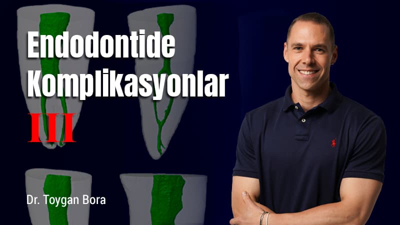 Endodontide Komplikasyonlar - III