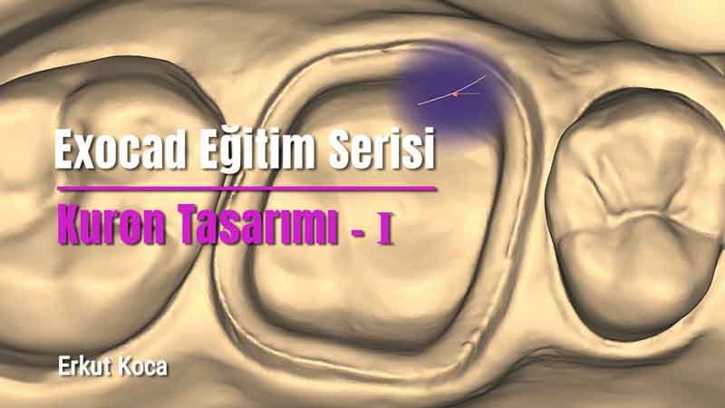 Exocad Eğitim Serisi - Kuron Tasarımı - I