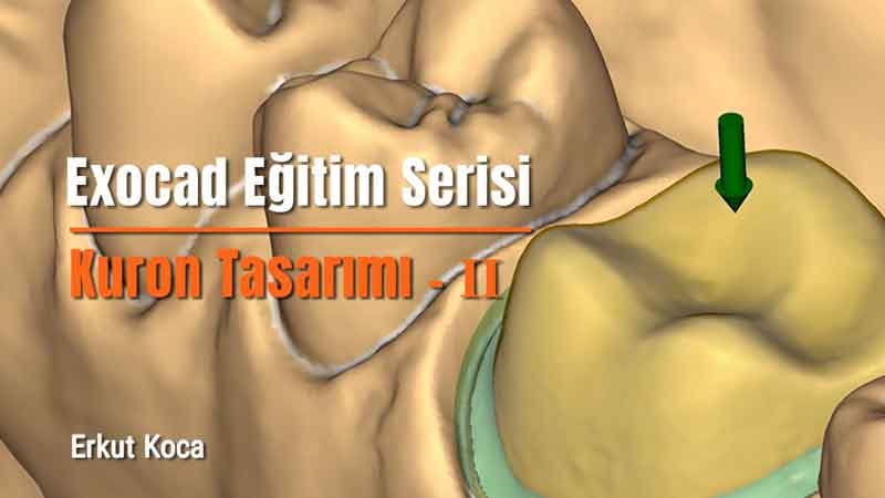 Exocad Eğitim Serisi - Kuron Tasarımı - II 