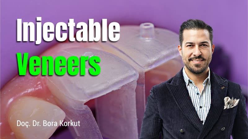 Injectable Veneers