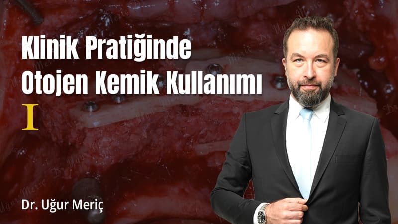 Klinik Pratiğinde Otojen Kemik Kullanımı - I