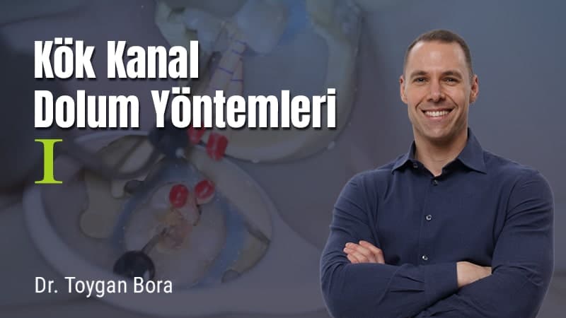Kök Kanal Dolum Yöntemleri - I