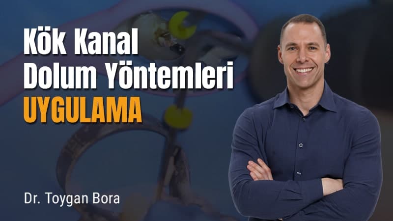 Kök Kanal Dolum Yöntemleri - Uygulama