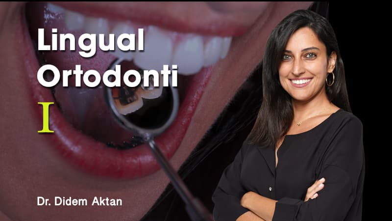 Lingual Ortodonti - I
