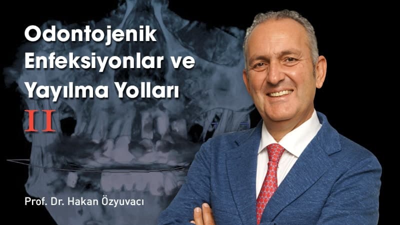 Odontojenik Enfeksiyonlar - II