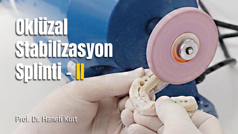Oklüzal Stabilizasyon Splinti - II 