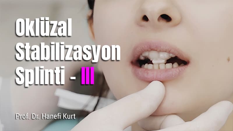 Oklüzal Stabilizasyon Splinti - III 