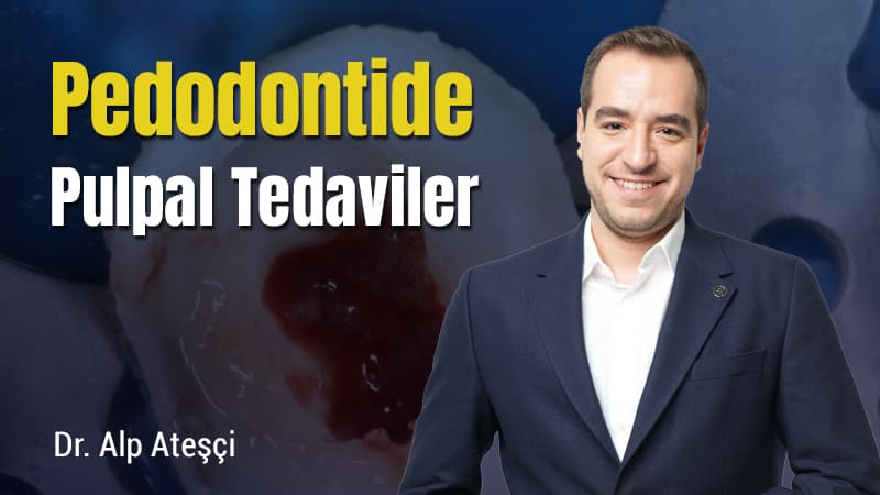 Pedodontide Pulpal Tedaviler