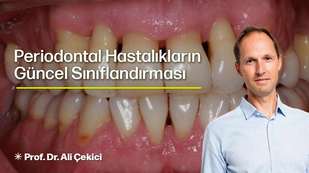 Periodontal Hastalıkların Güncel Sınıflandırması