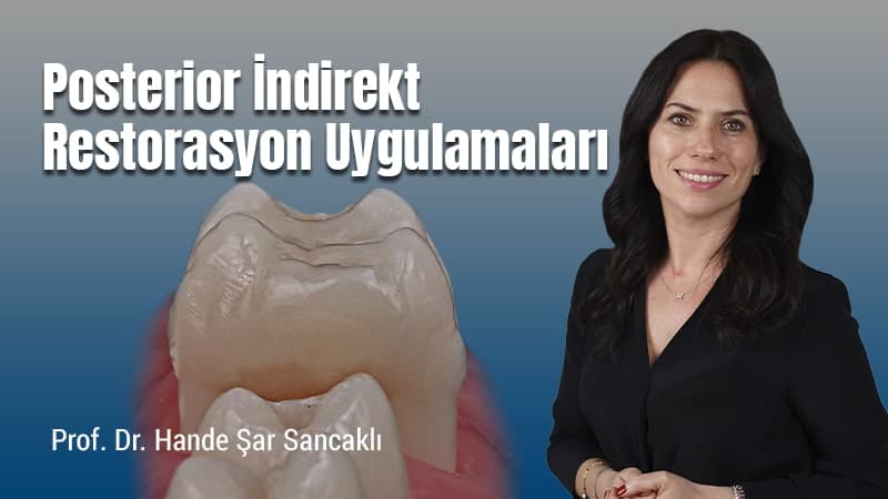 Posterior İndirekt Restorasyon Uygulamaları