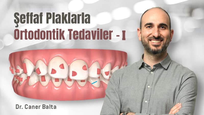 Şeffaf Plaklarla Ortodontik Tedaviler - I