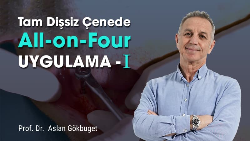 Tam Dişsiz Çenede All - On - Four - I 