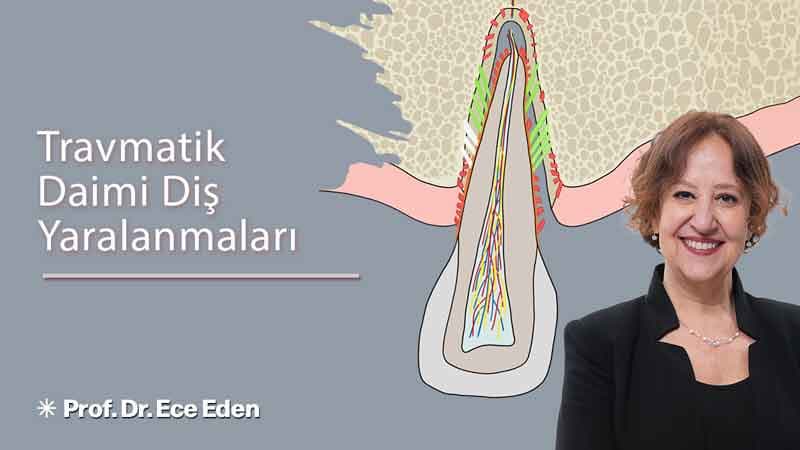 Travmatik Daimi Diş Yaralanmaları