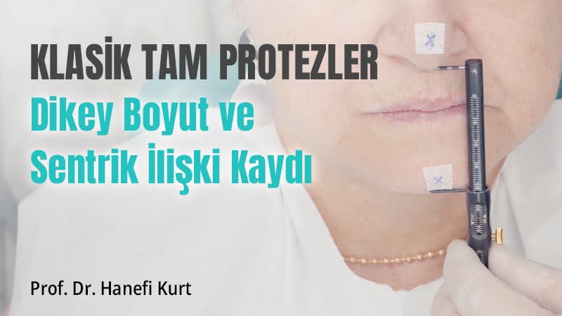 Klasik Tam Protezler - Dikey Boyut ve Sentrik İlişki Kaydı