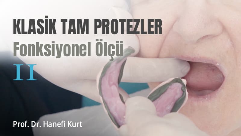 Klasik Tam Protezler - Fonksiyonel Ölçü - II