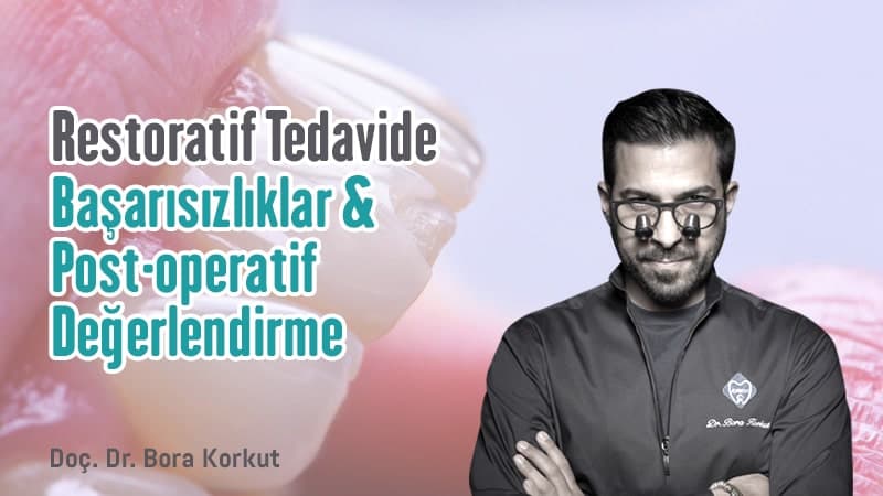Restoratif Tedavide Başarısızlıklar & Post-operatif Değerlendirme